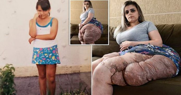 karina-rodini-giant-leg