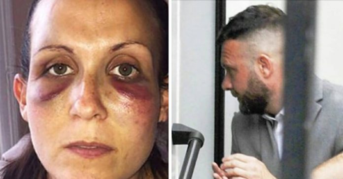 wife-attacked-by-husband