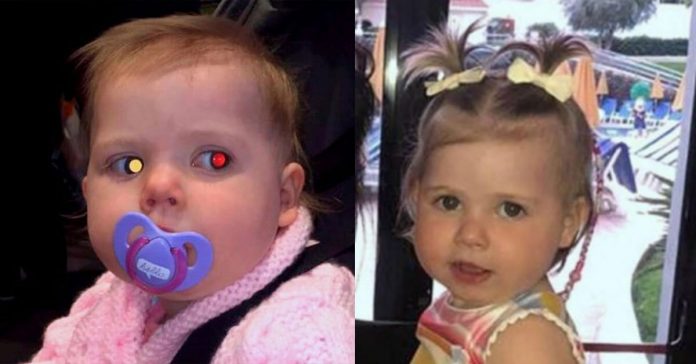cancerous-tumor-in-childs-eye