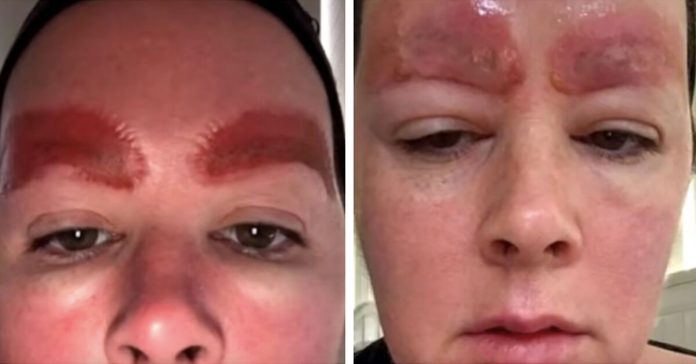infection-after-microblading-eyebrows