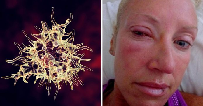 mom-blind-parasitic-worm