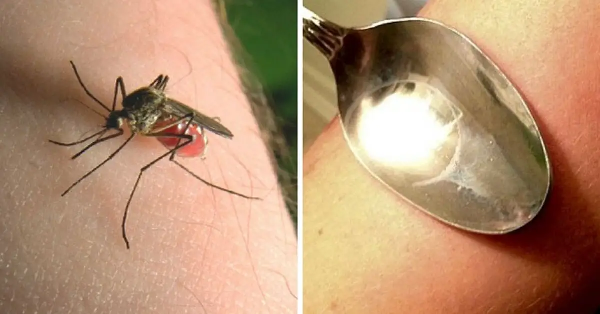 how to get rid of mosquito bites stop itching