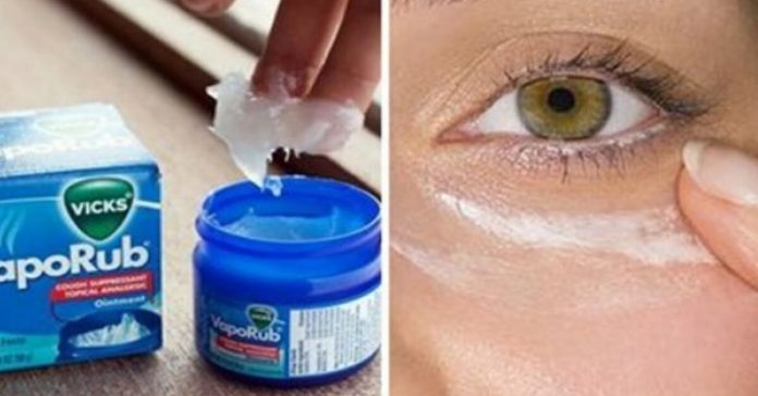 uses-for-vicks-vaporub