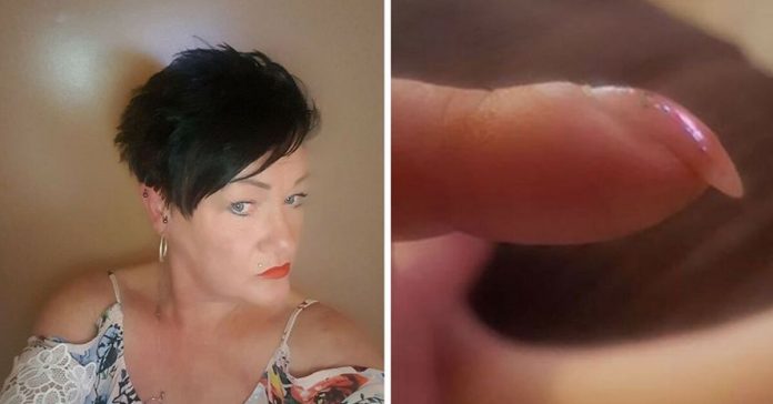 woman-cancer-nails-facebook