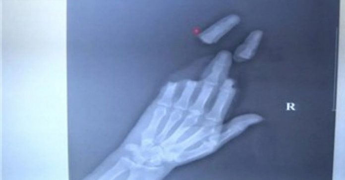 fly-kite-slice-fingers