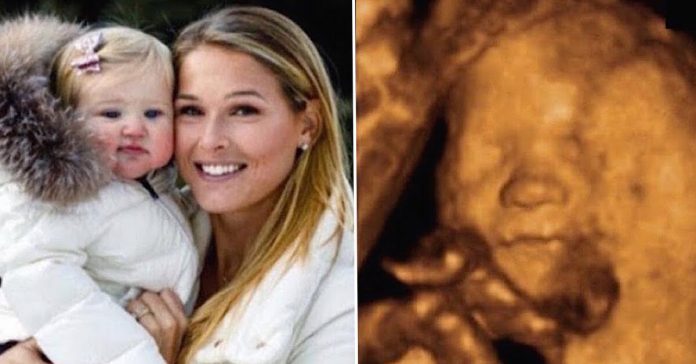 morgan-miller-ultrasound-scan