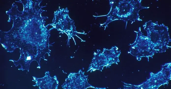 Israeli-Scientists-Cure-For-Cancer